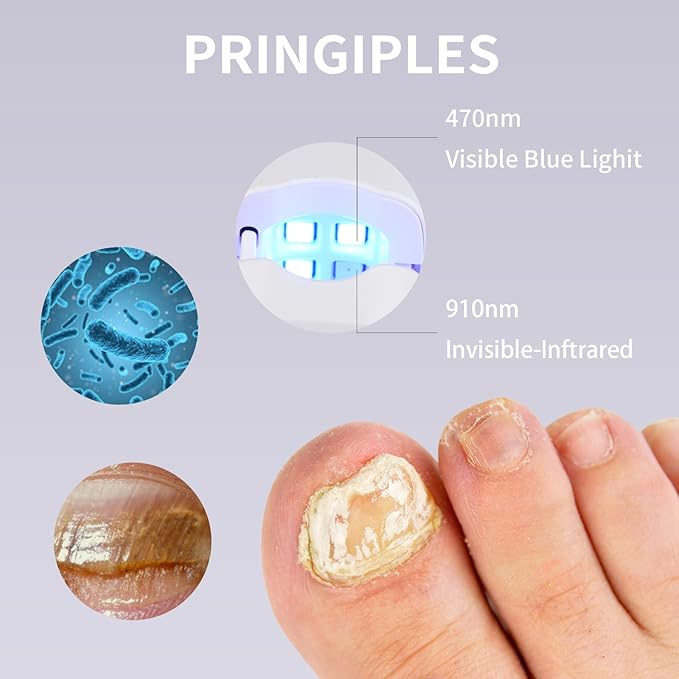 Rechargeable Nail Fungus Cleaning Laser Device