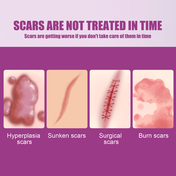 Scar Removal Cream