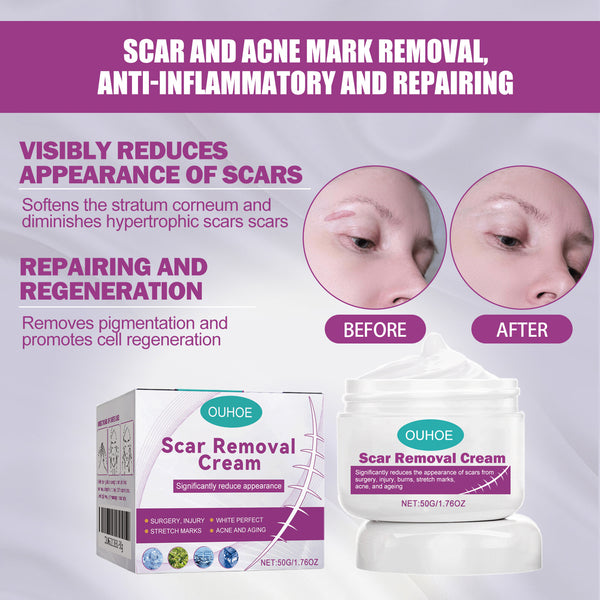 Scar Removal Cream